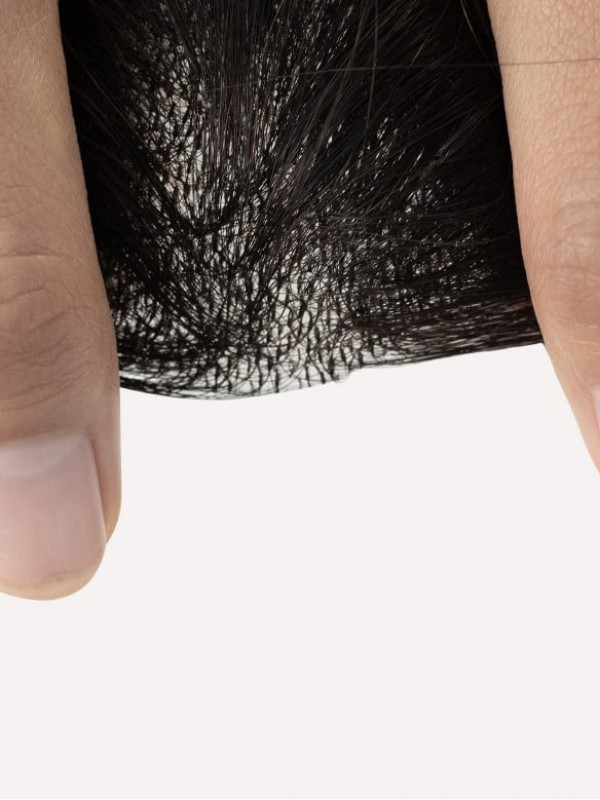 3 "* 3" Full Skin Base Menselijk Haar Cover Up Haar Patches Geen Chirurgische Oplossing Voor Alopecia Areata