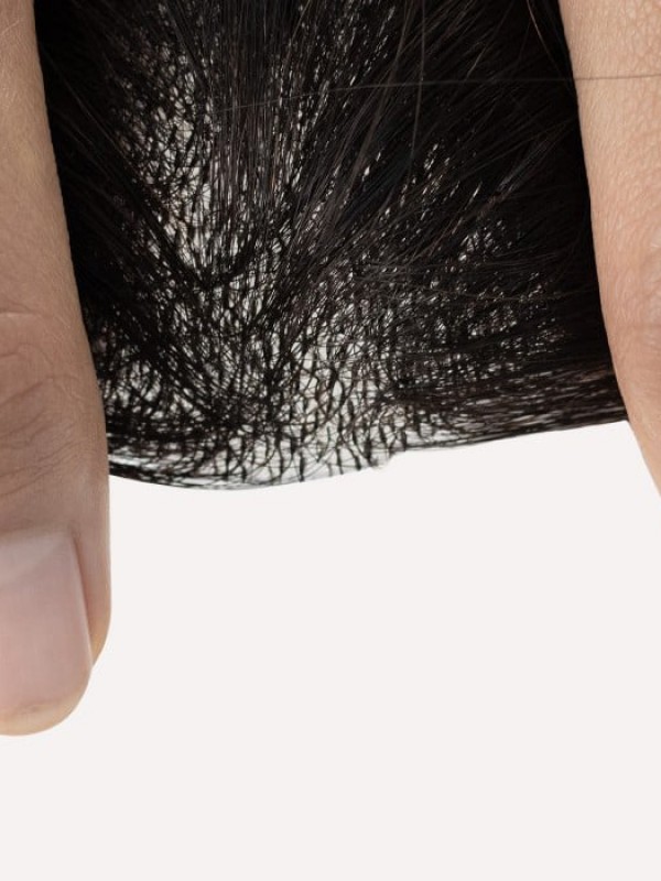 2 "* 2" Full Skin Base Human Hair Cover Up Hair Patches Geen Chirurgische Oplossing Voor Alopecia Areata