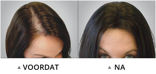 Before and After Before and After